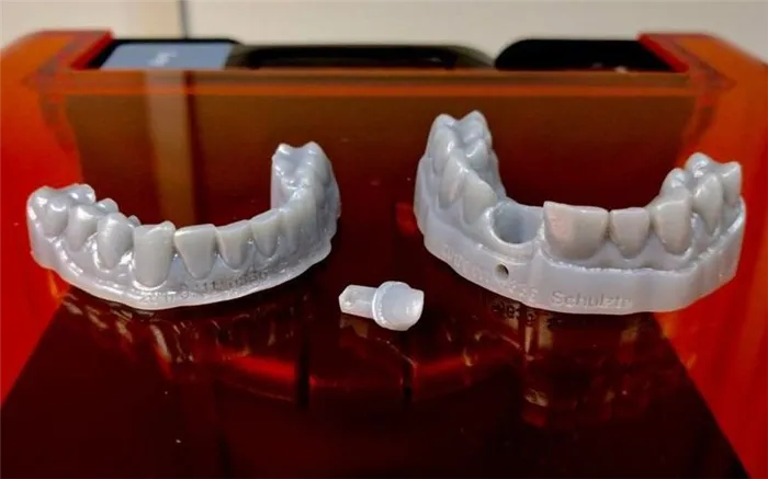 3D-печать зубов